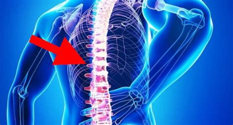 osteoartrita spatelui durere de spate dreapta
